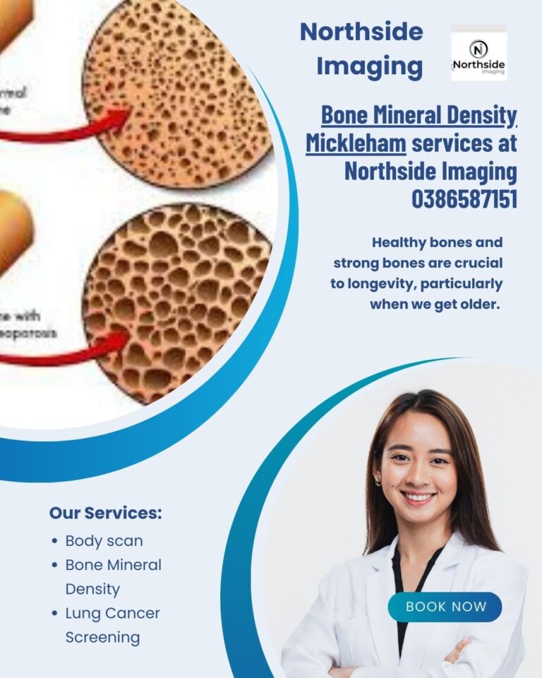 Bone Mineral Density Mickleham 768x960